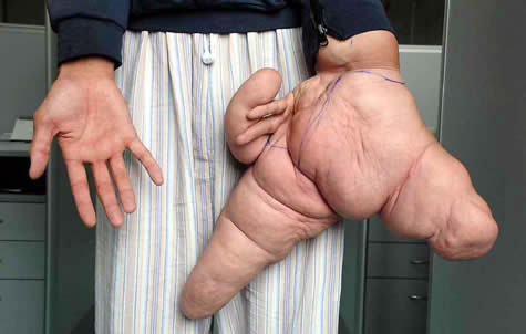 World's Largest Hands 