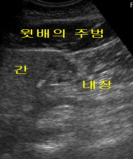 사용자 삽입 이미지