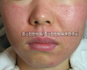사용자 삽입 이미지